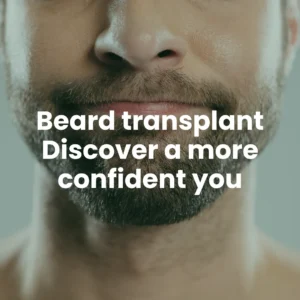 Beard transplant