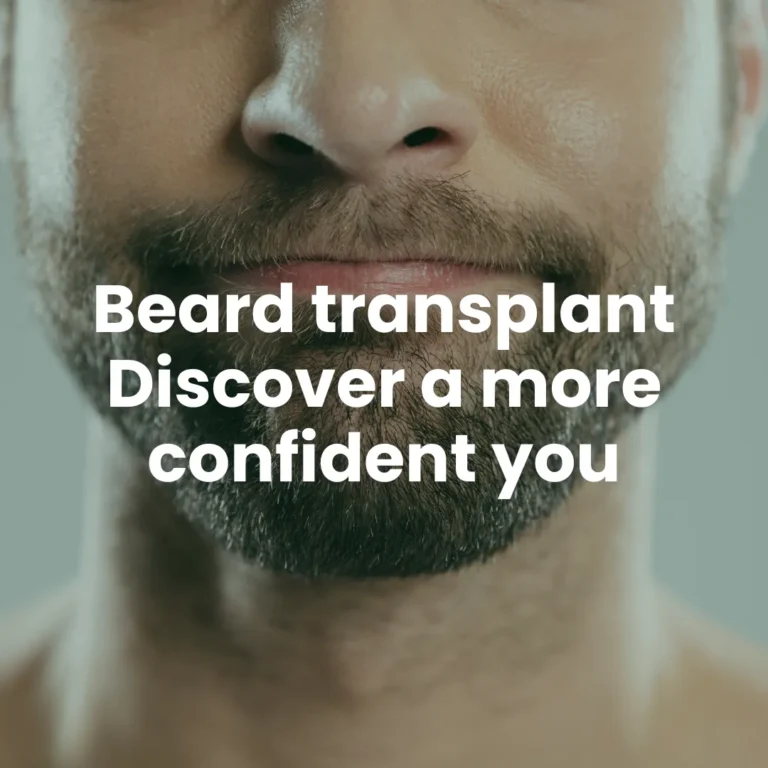 Beard transplant