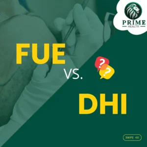 FUE Sapphire and DHI