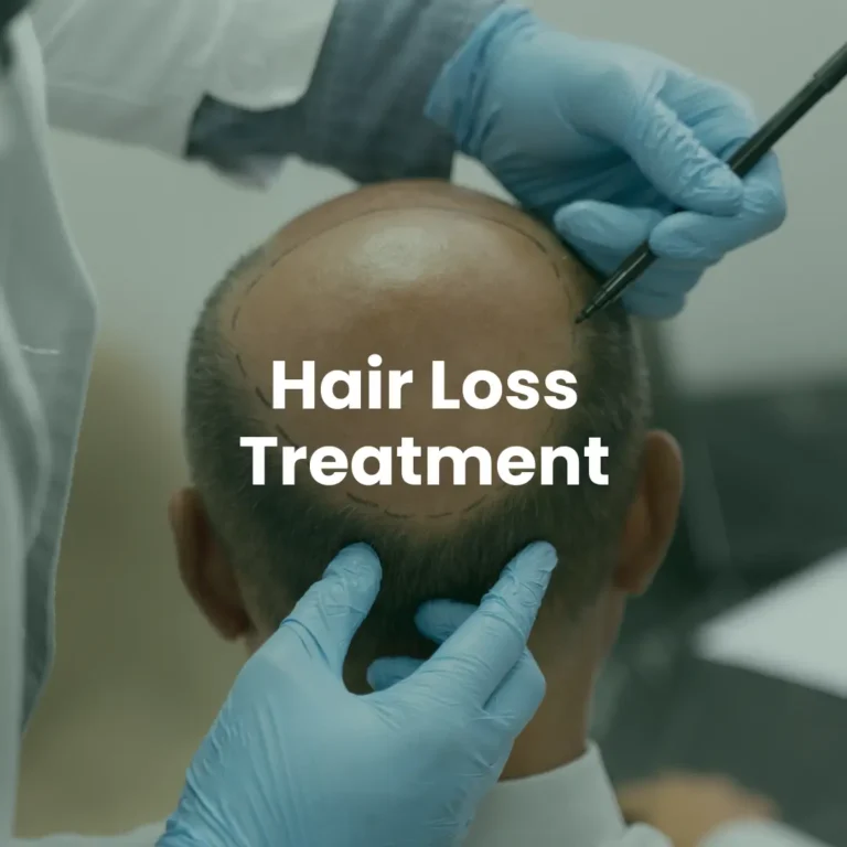 Hair Loss Treatment